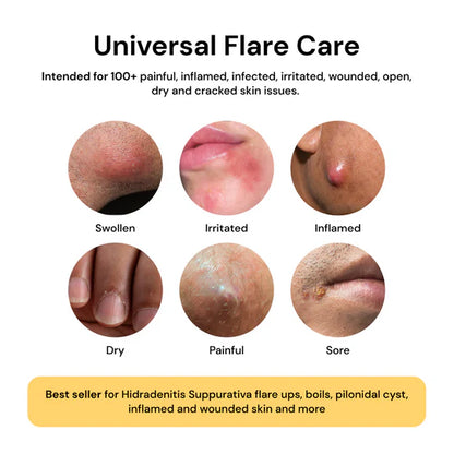 Universial Flare Care