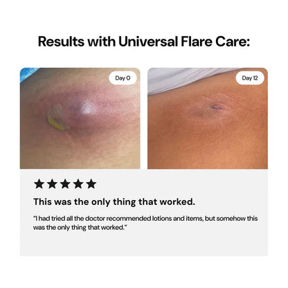Universial Flare Care