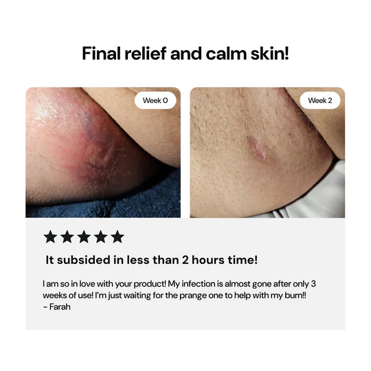 Universial Flare Care