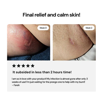 Universial Flare Care